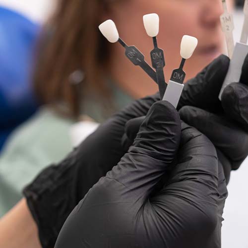 dental-veneers-a-dent